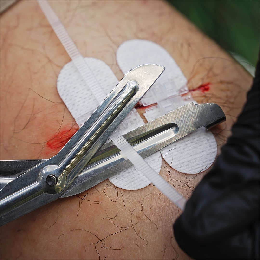 Wound Closure Kit (10-teilig)