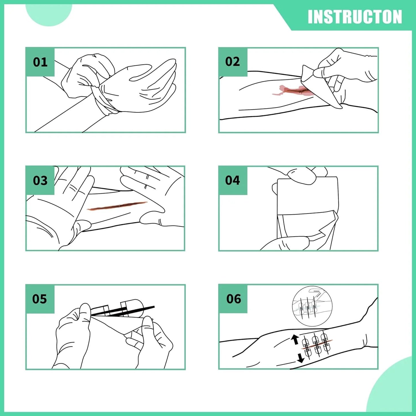 Wound Closure Kit (10-teilig)