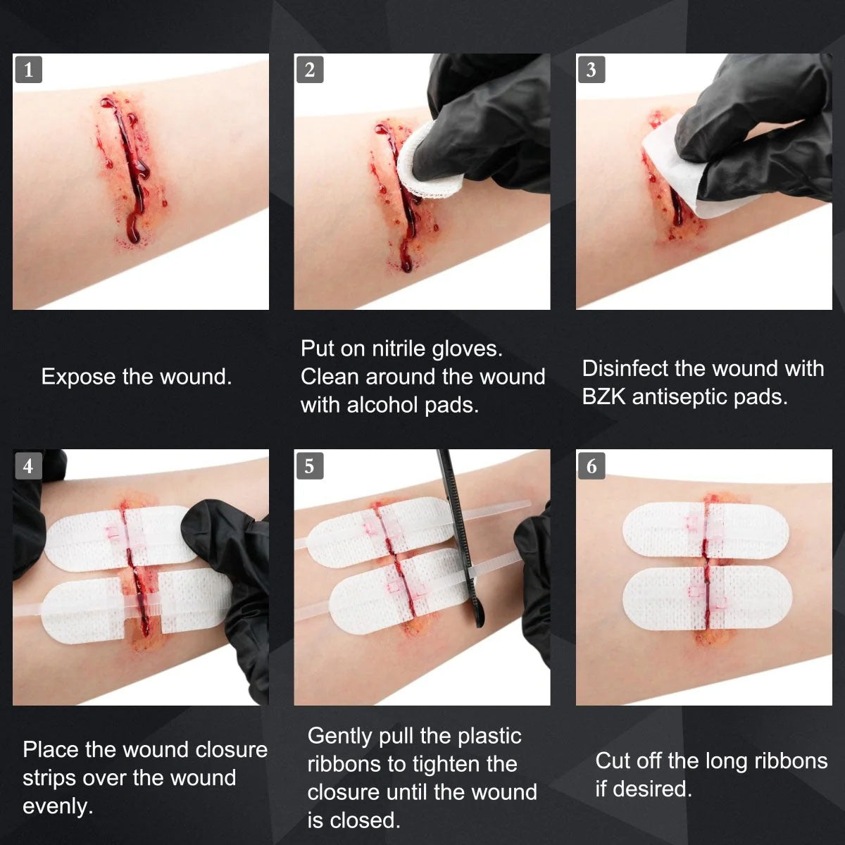 Wound Closure Kit (10-teilig)